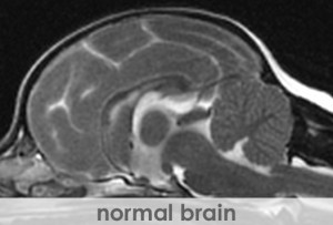 MRI-NormalBrain