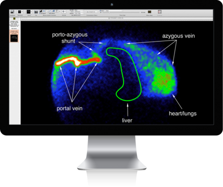 mac-display-overlay-PortoazygousShunt