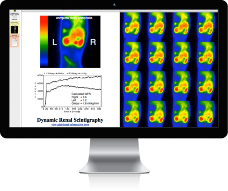 mac-display-overlay-renal