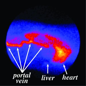 Figure 3. Composite image showing the uptake of a radioactive dye from the rectum into the portal vein. Notice that the dye bypasses the liver and appears in the heart and lungs first.