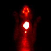 Figure 5. Thyroid scintigraphy in a cat with marked hyperthyroidism secondary to thyroid carcinoma. Notice the extension of the disease beyond the normal extession of the thyroid capsule. This represents regional metastasis.