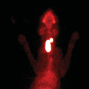 Figure 4. Thyroid scintigraphy in a cat with hyperthyroidism secondary to bilateral asymmetric adenomatous thyroid hyperplasia.