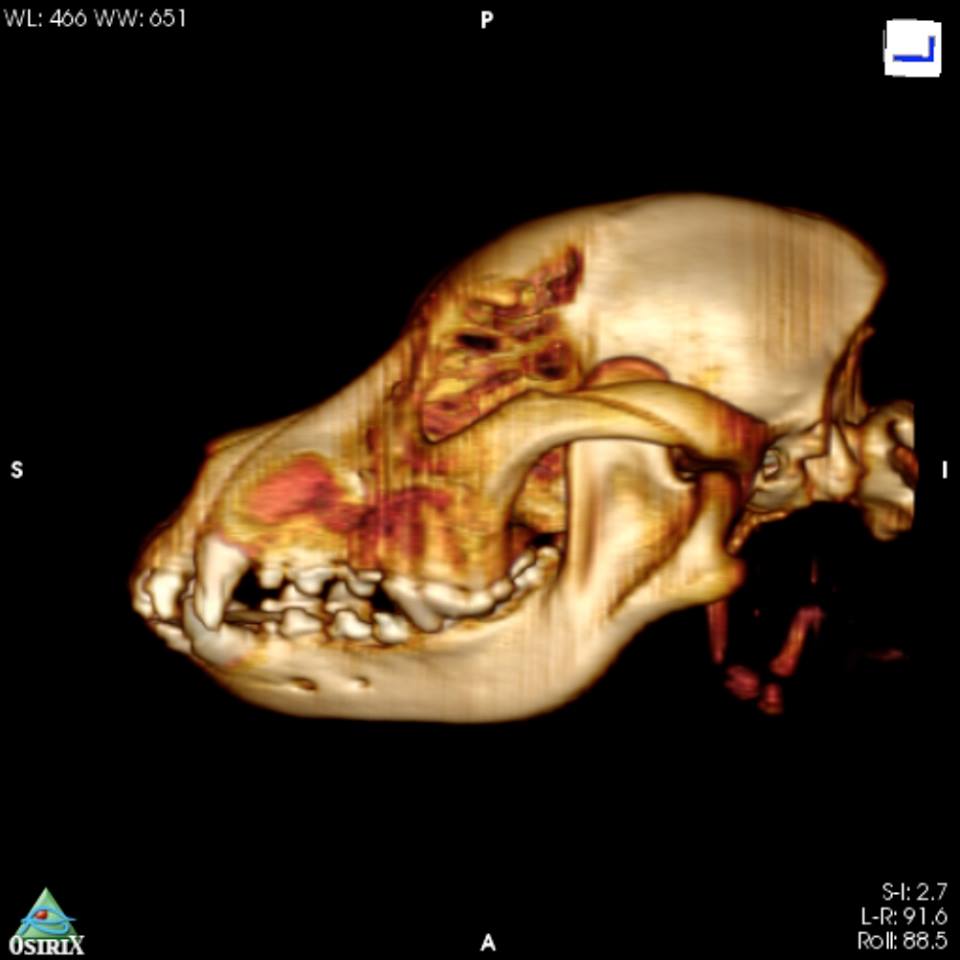 CT reconstruction