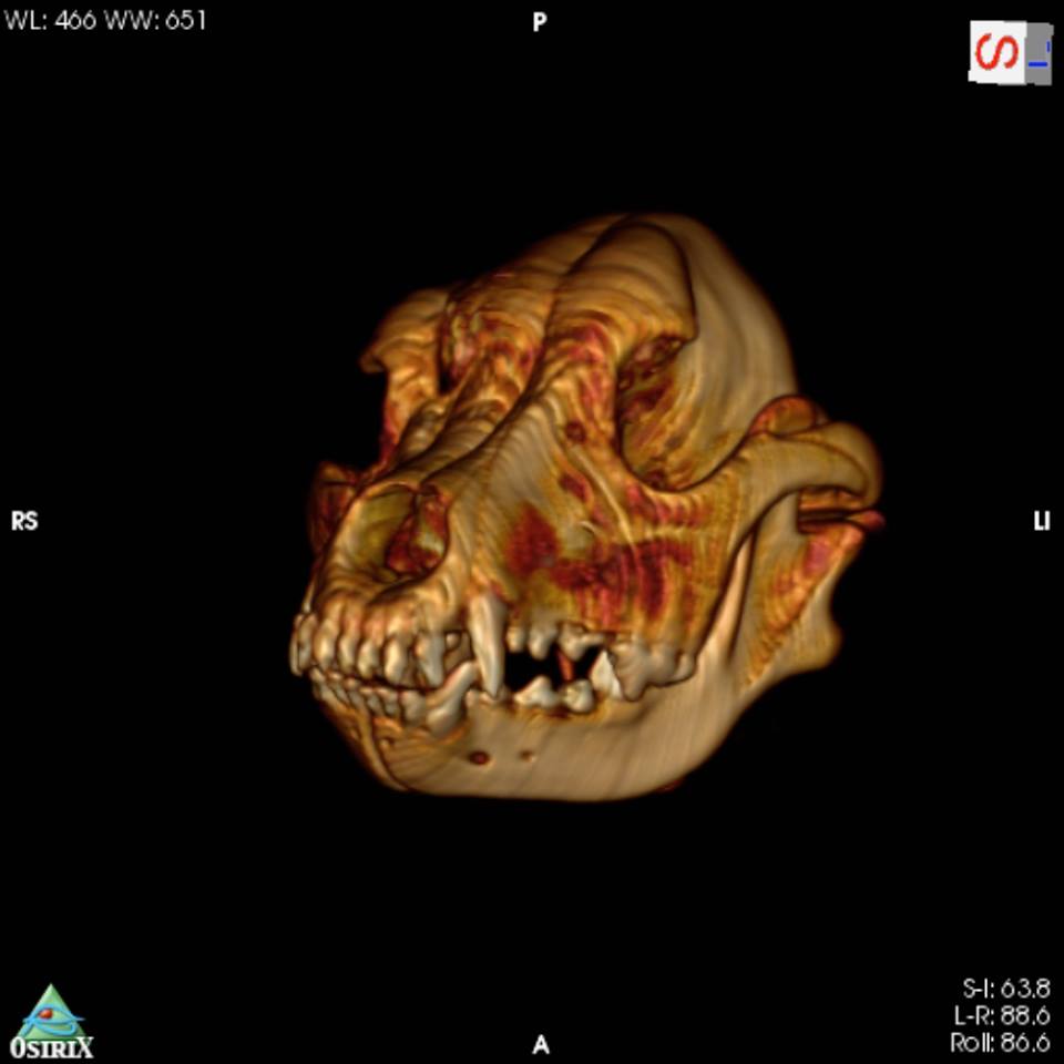 CT reconstruction