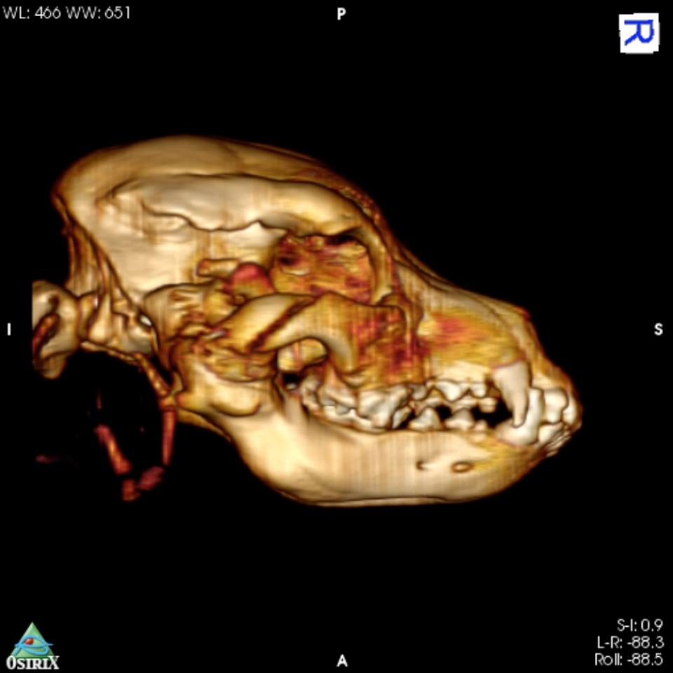 CT reconstruction