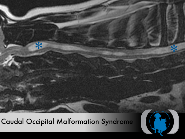 Caudal Occipital Malformation Syndrome