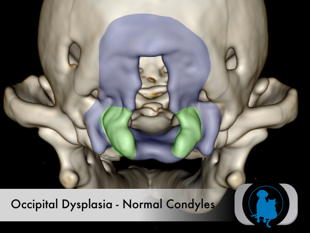 Occipital dysplasia - attenuated condyles